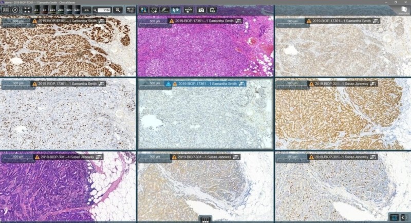 Case Viewer 數位玻片影像閱片軟體
